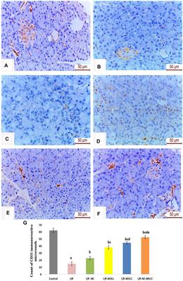 Combined Systemic Intake of K-ATP Opener (Nicorandil) and Mesenchymal Stem Cells Preconditioned With Nicorandil Alleviates Pancreatic Insufficiency in a Model of Bilateral Renal Ischemia/Reperfusion Injury